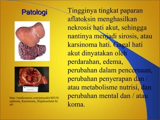 Patologi

http://medicastore.com/penyakit/603/H
epatoma_Karsinoma_Hepatoseluler.ht
ml

Tingginya tingkat paparan
aflatoksin menghasilkan
nekrosis hati akut, sehingga
nantinya menjadi sirosis, atau
karsinoma hati. Gagal hati
akut dinyatakan oleh
perdarahan, edema,
perubahan dalam pencernaan,
perubahan penyerapan dan /
atau metabolisme nutrisi, dan
perubahan mental dan / atau
koma.

 