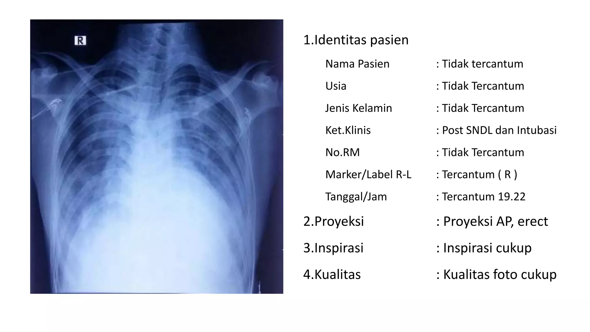 Tugas Radiologi | PPTX