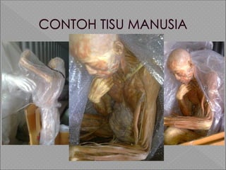 TUGAS PPKP DI PELABUHAN