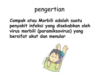 pengertian
Campak atau Morbili adalah suatu
penyakit infeksi yang disebabkan oleh
virus morbili (paramiksovirus) yang
bersifat akut dan menular
 