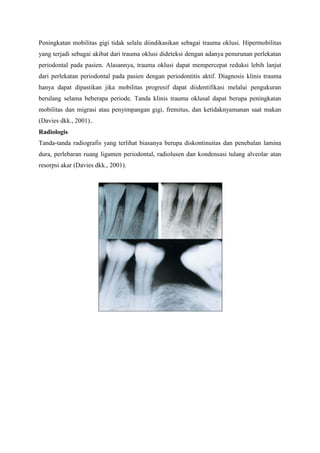 Peningkatan mobilitas gigi tidak selalu diindikasikan sebagai trauma oklusi. Hipermobilitas
yang terjadi sebagai akibat dari trauma oklusi dideteksi dengan adanya penurunan perlekatan
periodontal pada pasien. Alasannya, trauma oklusi dapat mempercepat reduksi lebih lanjut
dari perlekatan periodontal pada pasien dengan periodontitis aktif. Diagnosis klinis trauma
hanya dapat dipastikan jika mobilitas progresif dapat diidentifikasi melalui pengukuran
berulang selama beberapa periode. Tanda klinis trauma oklusal dapat berupa peningkatan
mobilitas dan migrasi atau penyimpangan gigi, fremitus, dan ketidaknyamanan saat makan
(Davies dkk., 2001)..
Radiologis
Tanda-tanda radiografis yang terlihat biasanya berupa diskontinuitas dan penebalan lamina
dura, perlebaran ruang ligamen periodontal, radiolusen dan kondensasi tulang alveolar atan
resorpsi akar (Davies dkk., 2001).
 