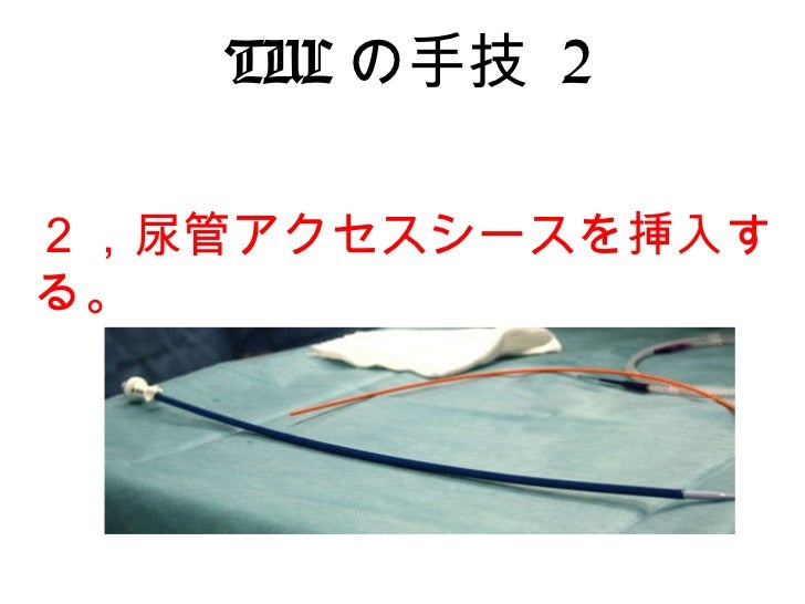 尿路結石 tul経尿道的尿管結石砕石術