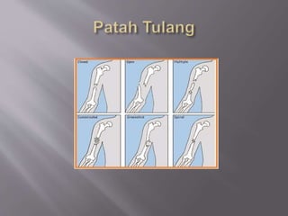 Tulang
