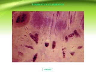 SUBOWOSUBOWO
PEMBENTUKAN ASBESTOS
 