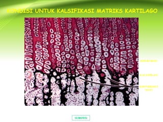 SUBOWOSUBOWO
KONDISI UNTUK KALSIFIKASI MATRIKS KARTILAGO
KHONDROSIT
MATI
KALSIFIKASI
HIPERTROFI
 