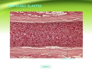 SUBOWOSUBOWO
KARTILAGO ELASTIS
PERIKHONDRIUM
 