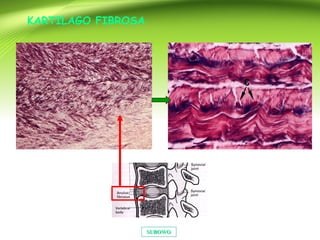 SUBOWOSUBOWO
KARTILAGO FIBROSA
 