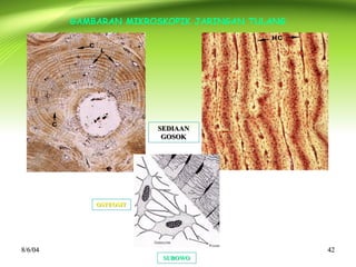 8/6/048/6/04 4242
SUBOWOSUBOWO
GAMBARAN MIKROSKOPIK JARINGAN TULANG
SEDIAAN
GOSOK
SEDIAAN
GOSOK
OSTEOSITOSTEOSIT
 