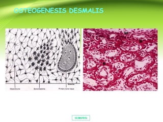 SUBOWOSUBOWO
OSTEOGENESIS DESMALIS
 