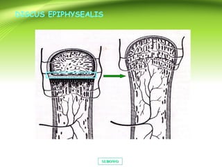 SUBOWOSUBOWO
DISCUS EPIPHYSEALIS
 