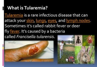 What isTularemia?
Tularemia is a rare infectious disease that can
attack your skin, lungs, eyes, and lymph nodes.
Sometimes it’s called rabbit fever or deer
fly fever. It’s caused by a bacteria
called Francisella tularensis.
 