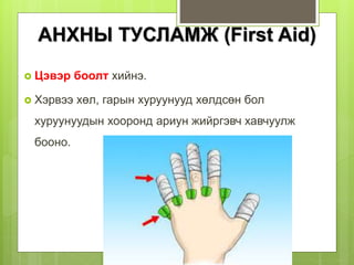  Цэвэр боолт хийнэ.
 Хэрвээ хөл, гарын хуруунууд хөлдсөн бол
хуруунуудын хооронд ариун жийргэвч хавчуулж
бооно.
АНХНЫ ТУСЛАМЖ (First Aid)
 