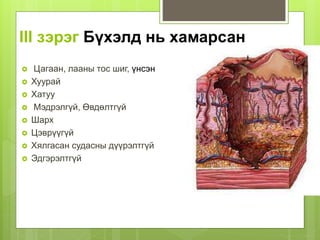 III зэрэг Бүхэлд нь хамарсан
 Цагаан, лааны тос шиг, үнсэн
 Хуурай
 Хатуу
 Мэдрэлгүй, Өвдөлтгүй
 Шарх
 Цэврүүгүй
 Хялгасан судасны дүүрэлтгүй
 Эдгэрэлтгүй
 