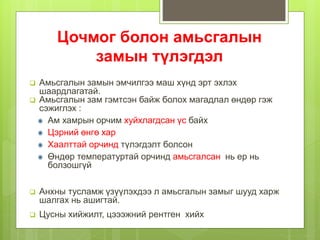 Цочмог болон амьсгалын
замын түлэгдэл
 Амьсгалын замын эмчилгээ маш хүнд эрт эхлэх
шаардлагатай.
 Амьсгалын зам гэмтсэн байж болох магадлал өндөр гэж
сэжиглэх :
Ам хамрын орчим хуйхлагдсан үс байх
Цэрний өнгө хар
Хаалттай орчинд түлэгдэлт болсон
Өндөр температуртай орчинд амьсгалсан нь ер нь
болзошгүй
 Анхны тусламж үзүүлэхдээ л амьсгалын замыг шууд харж
шалгах нь ашигтай.
 Цусны хийжилт, цэээжний рентген хийх
 