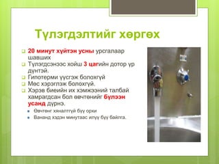 Түлэгдэлтийг хөргөх
 20 минут хүйтэн усны урсгалаар
шавших
 Түлэгдсэнээс хойш 3 цагийн дотор үр
дүнтэй.
 Гипотерми үүсгэж болохгүй
 Мөс хэрэглэж болохгүй.
 Хэрэв биеийн их хэмжээний талбай
хамрагдсан бол өвчтөнийг бүлээн
усанд дүрнэ.
Өвчтөнг хяналтгүй бүү орхи
Вананд хэдэн минутаас илүү бүү байлга.
 