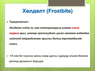 Хөлдөлт (Frostbite)
 Тодорхойлолт:
Хөлдөлт гэдэг нь нам температурын улмаас хэсэг
газрын арьс, улмаар эрхтнүүдийн цусан хангамж алдагдаж
хүйтэнд хайрагдсанаас арьсны бүтэц өөрчлөгдөхийг
хэлнэ.
 -15 хэм ба түүнээс доош хэмд цусны судсууд агшиж биеийн
дотоод дулааныг барьдаг.
 