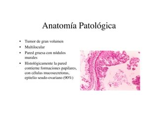 Anatomía Patológica
• Tumor de gran volumen
• Multilocular
• Pared gruesa con nódulos
  murales
• Histológicamente la pare...