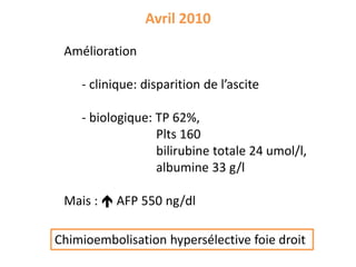 Avril 2010
Amélioration
- clinique: disparition de l’ascite
- biologique: TP 62%,
Plts 160
bilirubine totale 24 umol/l,
albumine 33 g/l
Mais :  AFP 550 ng/dl
Chimioembolisation hypersélective foie droit
 