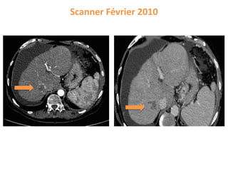 Scanner Février 2010
 