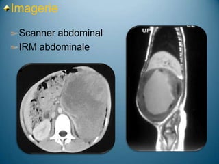 Imagerie
 Scanner abdominal
 IRM abdominale
 