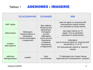 Tableau 1 ADENOMES : IMAGERIE
Claude EUGENE 12
ECHOGRAPHIE SCANNER IRM
HNF1-alpha
Hétérogène
Hyperéchogène si
stéatosique
...