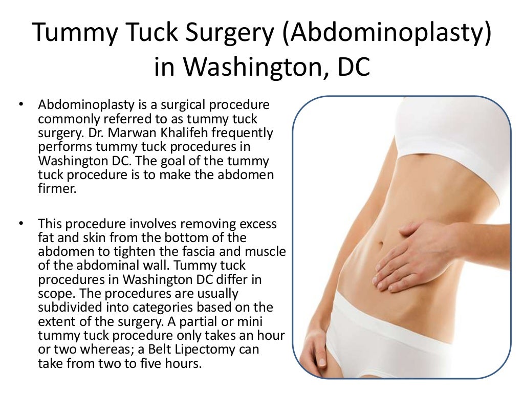 Tummy tuck surgery in Washington, Dc