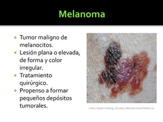  Tumor maligno de
melanocitos.
 Lesión plana o elevada,
de forma y color
irregular.
 Tratamiento
quirúrgico.
 Propenso a formar
pequeños depósitos
tumorales.
 