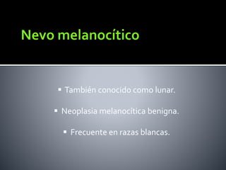  También conocido como lunar.
 Neoplasia melanocítica benigna.
 Frecuente en razas blancas.
 