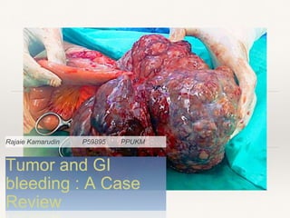 Tumor and GI
bleeding : A Case
Review
Rajaie Kamarudin P59895 PPUKM
 