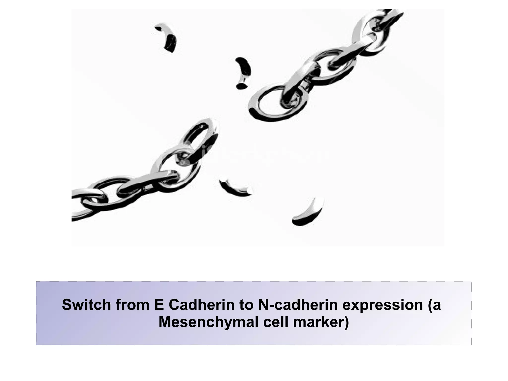 Switch from E Cadherin to N-cadherin expression (a
Mesenchymal cell marker)
 