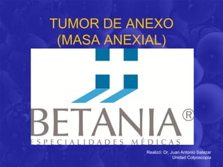 TUMOR DE ANEXO
(MASA ANEXIAL)
Realizó: Dr. Juan Antonio Salazar
Unidad Colposcopia
 