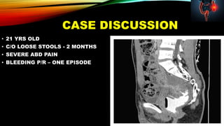 CASE DISCUSSION
• 21 YRS OLD
• C/O LOOSE STOOLS - 2 MONTHS
• SEVERE ABD PAIN
• BLEEDING P/R – ONE EPISODE
 