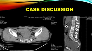 CASE DISCUSSION
 