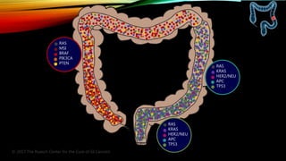 RAS
MSI
BRAF
PIK3CA
PTEN
RAS
KRAS
HER2/NEU
APC
TP53
RAS
KRAS
HER2/NEU
APC
TP53
© 2017 The Ruesch Center for the Cure of GI Cancers
 