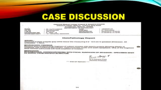 CASE DISCUSSION
 