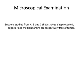 Microscopical Examination
Sections studied from A, B and C show shaved deep resected,
superior and medial margins are respectively free of tumor.
 