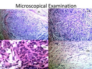 Microscopical Examination
4x 10X
40X
10X
40x
 