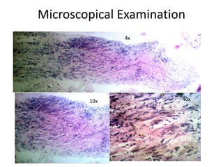 Microscopical Examination
4x
10x 40x
 