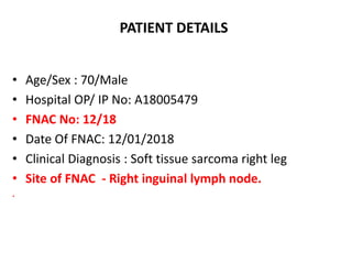 PATIENT DETAILS
• Age/Sex : 70/Male
• Hospital OP/ IP No: A18005479
• FNAC No: 12/18
• Date Of FNAC: 12/01/2018
• Clinical Diagnosis : Soft tissue sarcoma right leg
• Site of FNAC - Right inguinal lymph node.
.
 