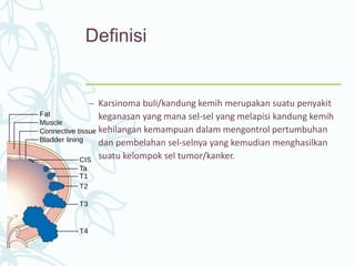 Definisi
– Karsinoma buli/kandung kemih merupakan suatu penyakit
keganasan yang mana sel-sel yang melapisi kandung kemih
kehilangan kemampuan dalam mengontrol pertumbuhan
dan pembelahan sel-selnya yang kemudian menghasilkan
suatu kelompok sel tumor/kanker.
 
