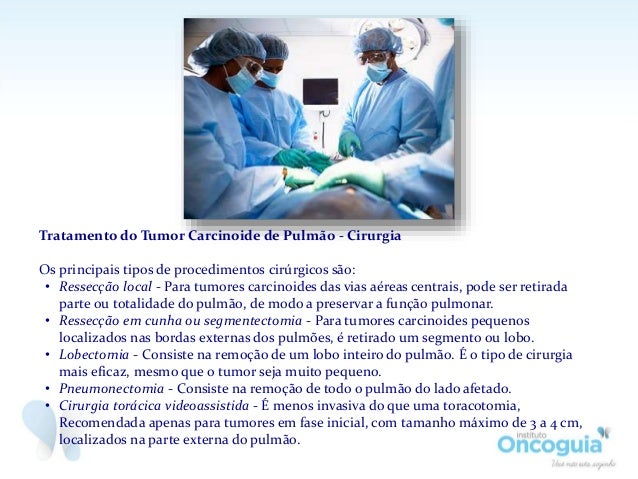 Tumor Carcinoide de Pulmão