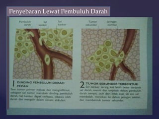 Penyebaran Lewat Pembuluh Darah
 