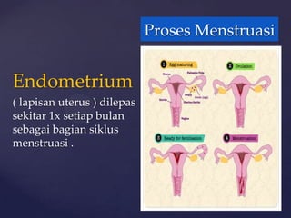 Proses Menstruasi


Endometrium
( lapisan uterus ) dilepas
sekitar 1x setiap bulan
sebagai bagian siklus
menstruasi .
 