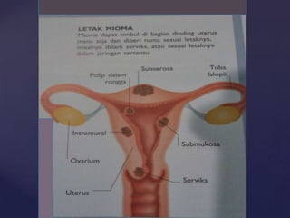    Gambar MIOMA hal. 227
 