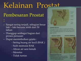 Kelainan Prostat
Pembesaran Prostat
:
   Sangat sering terjadi, sebagian besar
    laki – laki berusia lebih dari 50
    tahun
   Dianggap senbagai bagian dari
    proses penuaan
   Dapat menimbulkan gejala :
          - Sering buang air kecil (BAK )
          - Sulit memulai BAK
          - Aliran air seni lemah
          - Menetes
          - Tidak tuntas
 