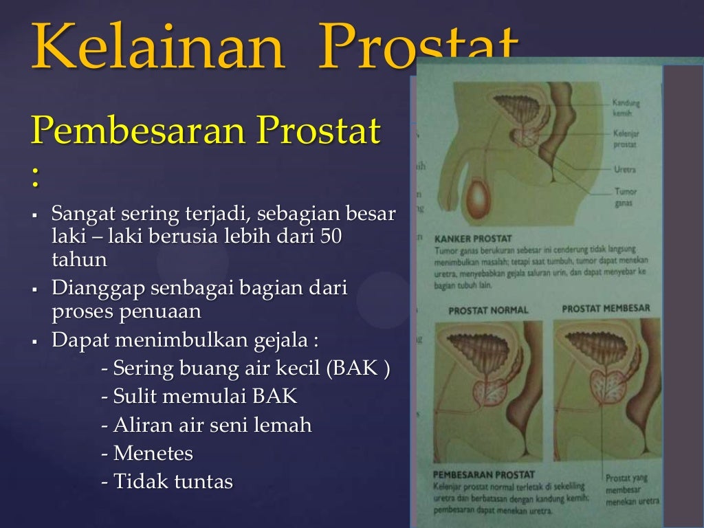 Mengenal Tumor Dan Kanker Beda Atau Sama Kesehatan Kontan