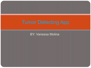 Tumor Detecting App

   BY: Vanessa Molina
 