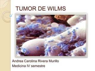 TUMOR DE WILMS  Andrea Carolina Rivera Murillo  Medicina IV semestre 