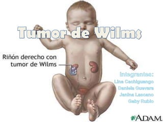 Tumor de Wilms Integrantes: Lina Cachiguango Daniela Guevara Janina Lascano Gaby Rubio 
