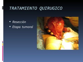 TRATAMIENTO QUIRUGICO

 Resección
 Etapa tumoral
 